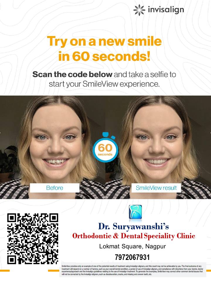 https://orthodontistnagpur.com/wp-content/uploads/2024/09/2.jpg