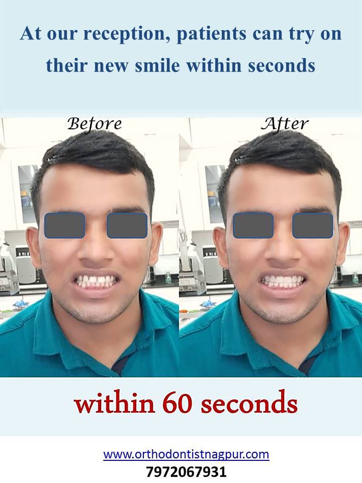 https://orthodontistnagpur.com/wp-content/uploads/2024/09/3.jpg