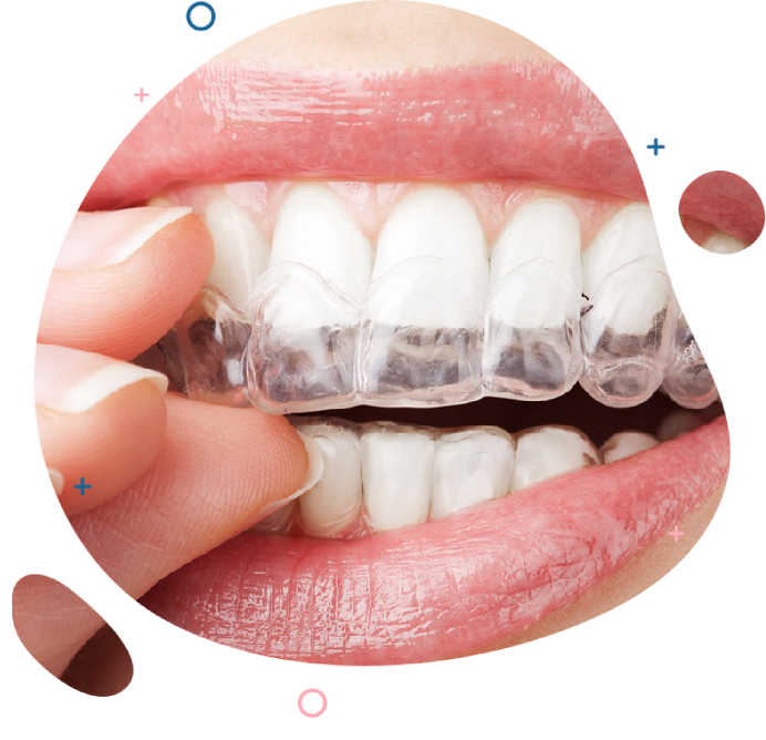 https://orthodontistnagpur.com/wp-content/uploads/2024/09/Crooked-Teeth1-1-2-2.png