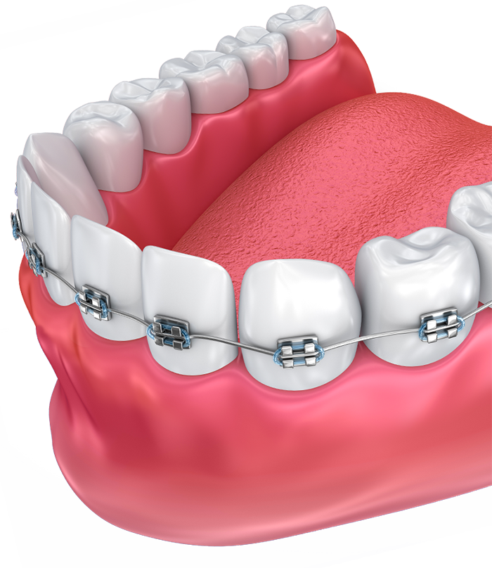 https://orthodontistnagpur.com/wp-content/uploads/2024/09/Daco_3433256.png