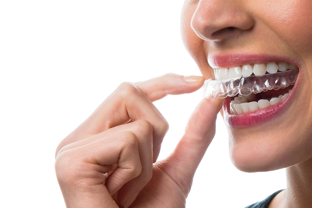 https://orthodontistnagpur.com/wp-content/uploads/2024/09/clear-aligner-removebg-preview.png