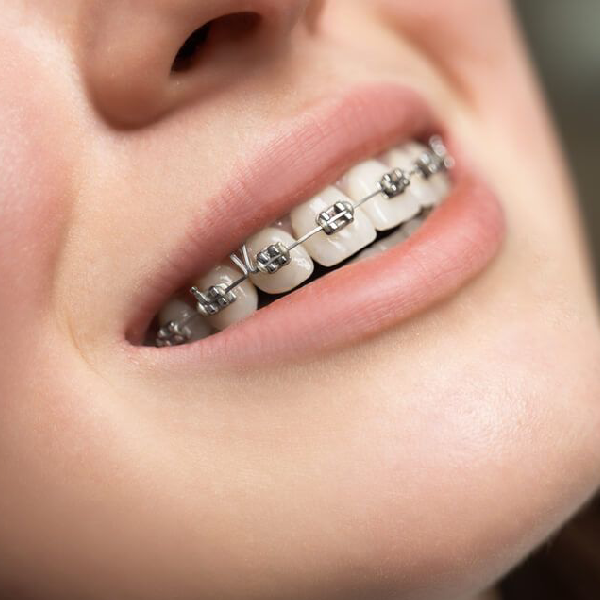 https://orthodontistnagpur.com/wp-content/uploads/2024/09/home-service-3-1-3.png