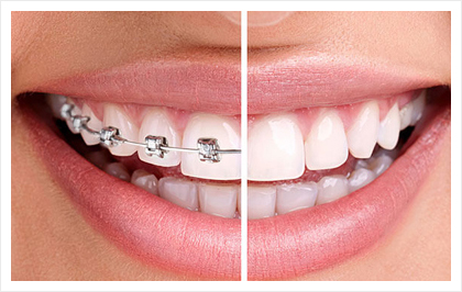 orthodontic2