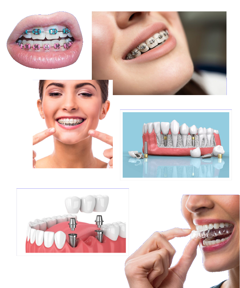 https://orthodontistnagpur.com/wp-content/uploads/2024/09/output-onlinepngtools-5.png