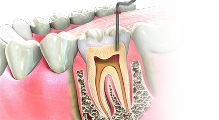 https://orthodontistnagpur.com/wp-content/uploads/2024/09/pngwing.com_.png