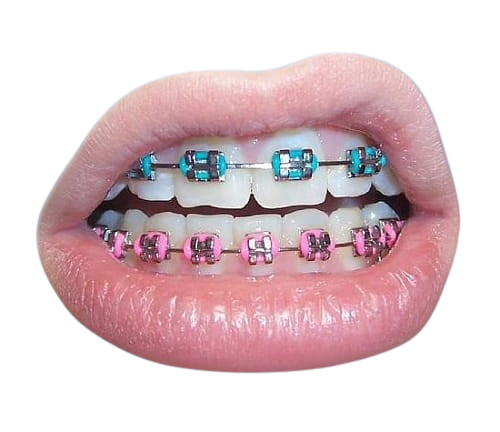 https://orthodontistnagpur.com/wp-content/uploads/2024/09/s-002-random-removebg-preview.png