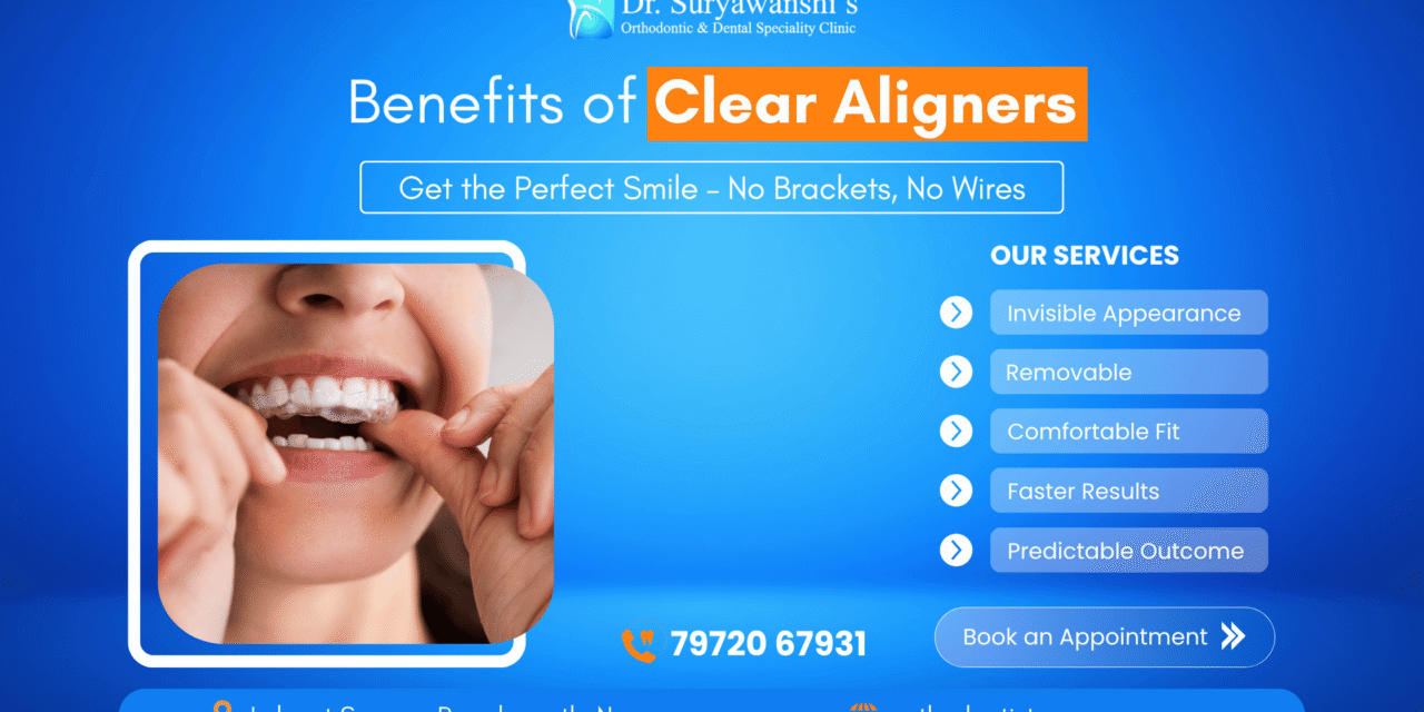 Benefits of Clear Aligners