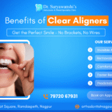 Benefits of Clear Aligners at Dr. Suryawanshi's Orthodontic & Dental Specialty Clinic